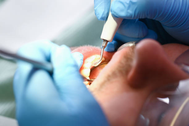 Best Emergency Gum Pain Relief  in Gig Harbor, WA